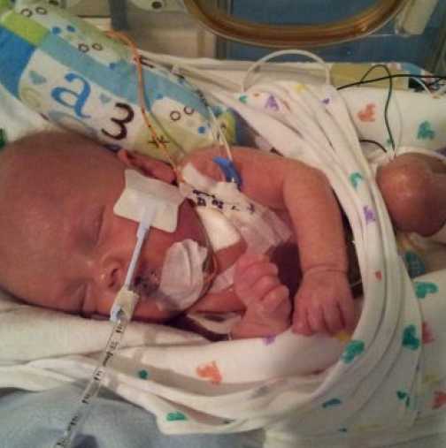 Спасиха живота на 10-дневно бебе, родено без отвори на носните кухини