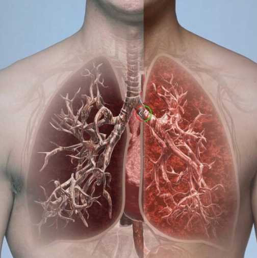 3 начина за изчистване на белите дробове от цигарите