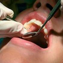 Пациентка съди зъболекар, който изпуснал инструмент в устата й и тя го глътнала