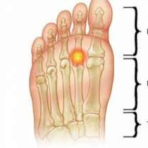 По краката можете да откриете важни неща и симптоми, свързани със здравето ви