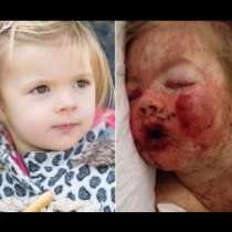 Внимание лекари и родители: Вижте какво се случи на 2-годишно дете след употребата на едно лекарство