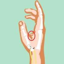 Как да отстраните главоболието с помощта на палеца и показалеца