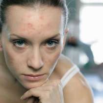 Промените в кожата, които са притеснителни сигнали за влошаване на здравето