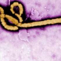 Тест открива за 15 минути, дали имаш ебола!