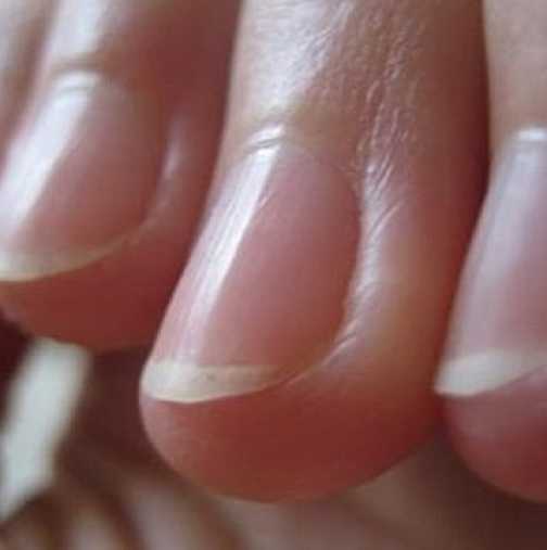 Разберете какво е здравословното състояние на човек по ноктите му: Чупещи се нокти-имате липса на ...