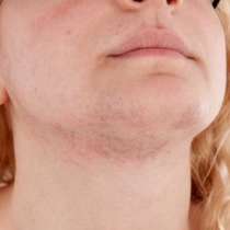 Как да спрем нежелано окосмяване по лицето