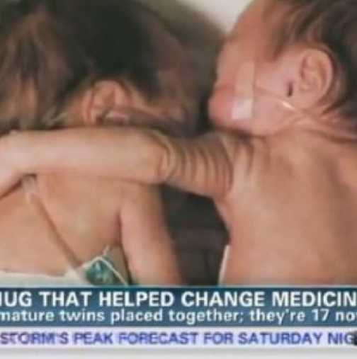 Бебето, което промени медицината - Спаси с прегръдка сестричката си в кувьоза