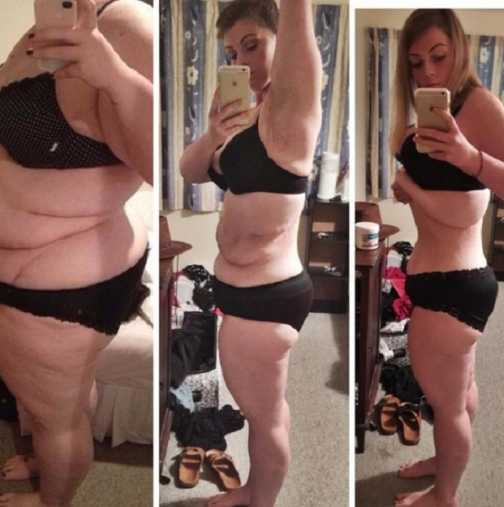 Загубила 55 кг, но тогава възникнал друг, по-голям проблем!