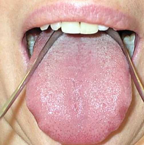 Почистване на езика за детоксикация на тялото, отслабване и добро здраве