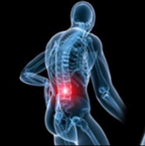 Рецепта на проф. Мармерски срещу болки в гърба