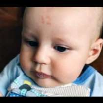 Злокобно: Бебе се роди с белег числото 12 на челото
