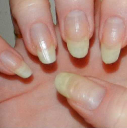 4 лесни и бързи начини да върнете хубавият, бял цвят на ноктите си и да ги направите супер здрави