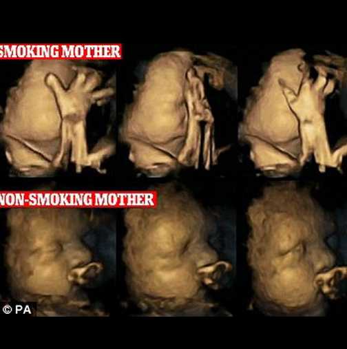 Ето какво се случва с нероденото бебе на майките, които пушат! (Видео)