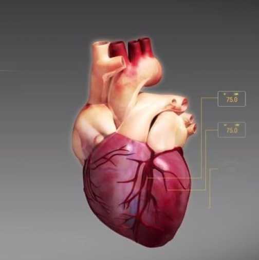 За първи път е извършена трансплантация на "мъртво" сърце!