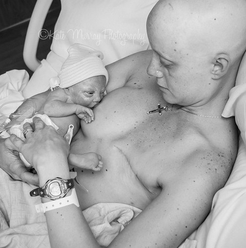 Силни снимки: Емоционална майка с рак на гърдата кърми новородения си син