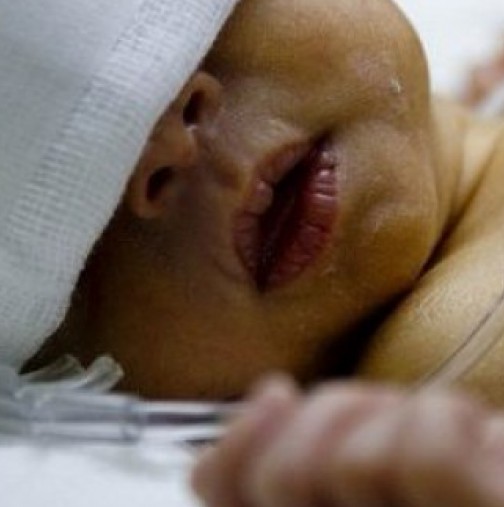 Бебе на 9 месеца почина от задушаване с кърма