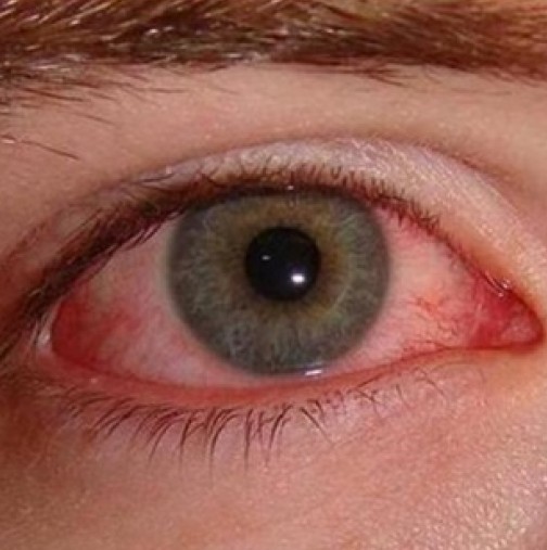 Как цветът на очите може да ви покаже от какво заболяване страдате?