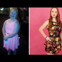 Трогателната история на момиче със синдрома на Даун, което става модел