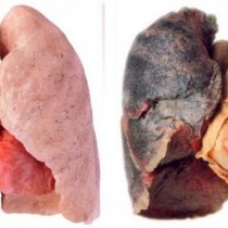Как естествено да изчистите белите дробове на катран и никотин?