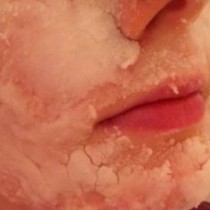 Трик, с който кожата ви ще свети: Почистете черните точки от лицето за 10 минути
