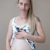 Медицински феномен: Родила, а все още изглежда бременна