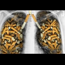 Специално за всички пушачи и хората около тях! Как да изчистите белите си дробове само с храни?