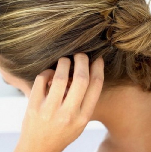 Косата ви е чиста, но нещо ви сърби: Има опасни последици, които трябва да предотвратите