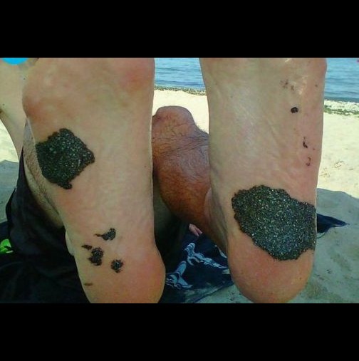Нещо става по българските плажове-Вижте какво се лепи по краката на туристи