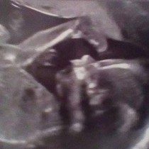 Бременна жена отиде на ултразвуков преглед - това, което видя я накара да изпадне в шок!