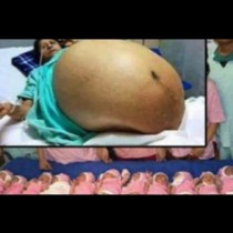 Лекарите в шок! Жена роди по естествен път 11 здрави момчета