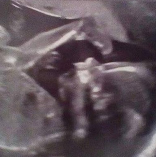 Бременна жена отиде на ултразвуков преглед - това, което видя я накара да изпадне в шок!