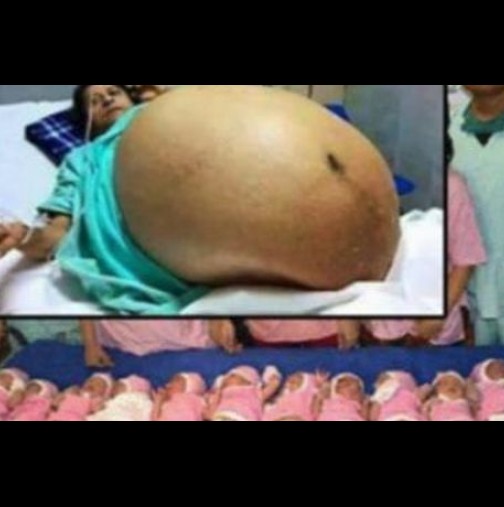 Лекарите в шок! Жена роди по естествен път 11 здрави момчета