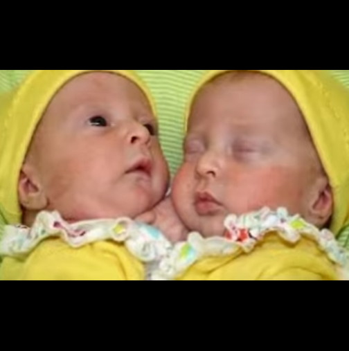 Лекарите ѝ съобщиха, че ще има сиамски близнаци и я увещаваха да не ражда-Тя не ги послуша и вижте какви са сега!