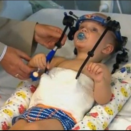 На това бебе му се е отделила главата от врата. Това, което направили докторите е изумително!