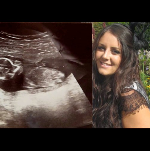 Лекарите се шокират, когато 10 дни след спонтанен аборт, от утробата на тази жена, чуват удари на малко ...