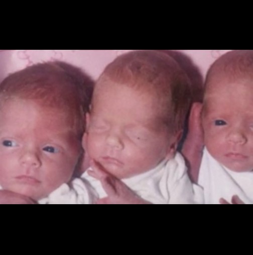 Преживяват жестоко изгаряне-Вижте снимка на тези три момичета 27 години по-късно! 