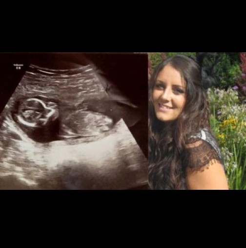 Лекари в шок - 10 дни след аборт, нещо в 31-годишна жена се обърква...