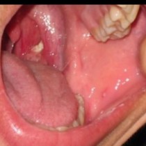 Една жена имала лош дъх в устата си, без да има видима причина за това, но когато отишла на лекар, открили нещо шокиращо!