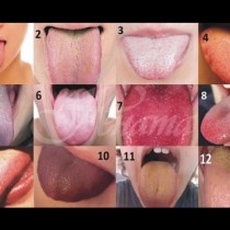 Състоянието на езика подсказва за болестите ни - разпознайте своя език по снимката!