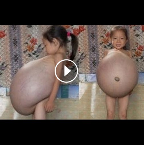 Шокираща история, от която ще настръхнете: 4 годишно момиченце, което като че ли е бременно (Видео)