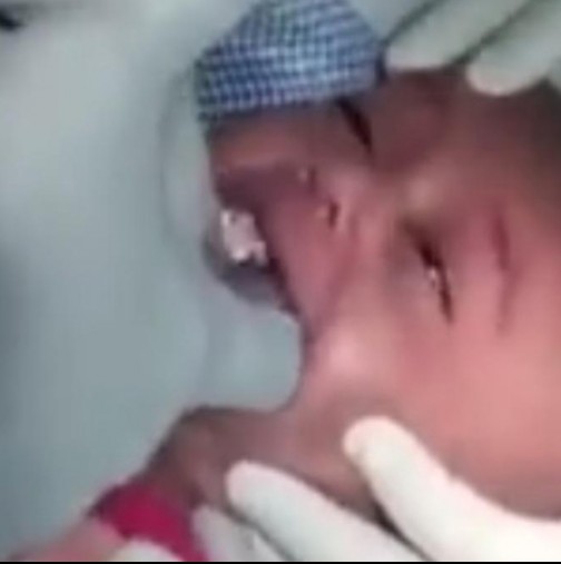 Бебето пристига в болницата в смъртоносно мълчание, а родителите преживяват най-големия кошмар, докато изваждат от гърлото му ...