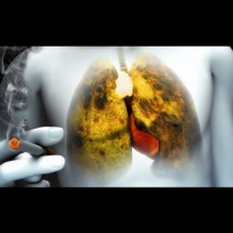 За пушачи и бивши пушачи: Вижте как бързо и ефективно да изчистите белия дроб само за 3 дни!
