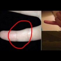 НЕЗАБАВНО преверете: Имате ли и вие такава деформация на малкия пръст на ръката?