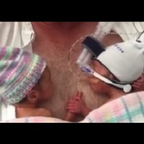 Видео с над 6 милиона прегледи: Преждевременно родени близнаци не искат да се пуснат!