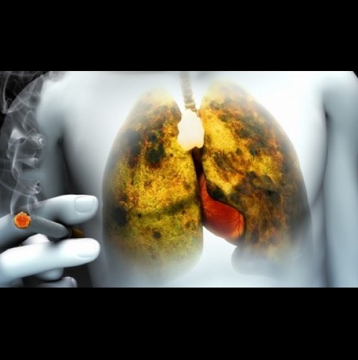 За пушачи и бивши пушачи: Вижте как бързо и ефективно да изчистите белия дроб само за 3 дни!