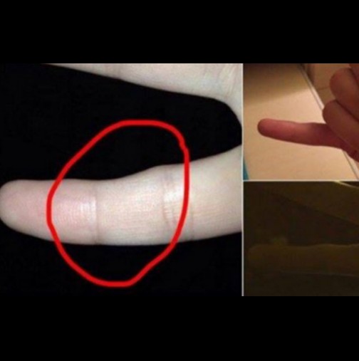 НЕЗАБАВНО преверете: Имате ли и вие такава деформация на малкия пръст на ръката?