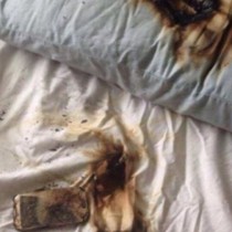 Момиче се събуди от горящата си възглавница! Когато се окопити, бе поразена от причината за пожара