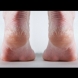 Една капка от това масло и край с проблемните пети! Вижте още колко проблема решава!
