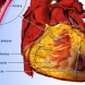 Известен кардиохирург разкри истинските причини за сърдечно-съдовите заболявания-Измамата с холестерола