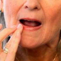 Жена си залепи устните, като обърка червилото с лепило	